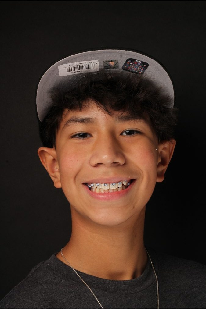Smile 4 Less patient